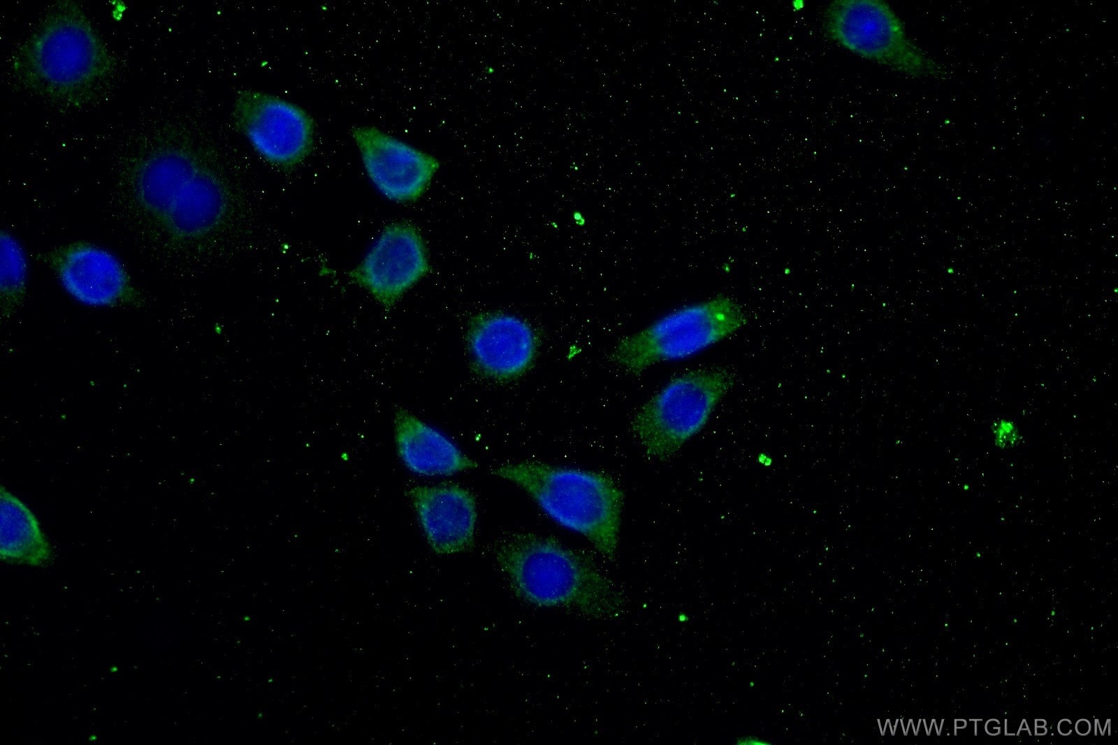 Immunofluorescence (IF) / fluorescent staining of HeLa cells using ATP9A Polyclonal antibody (19504-1-AP)