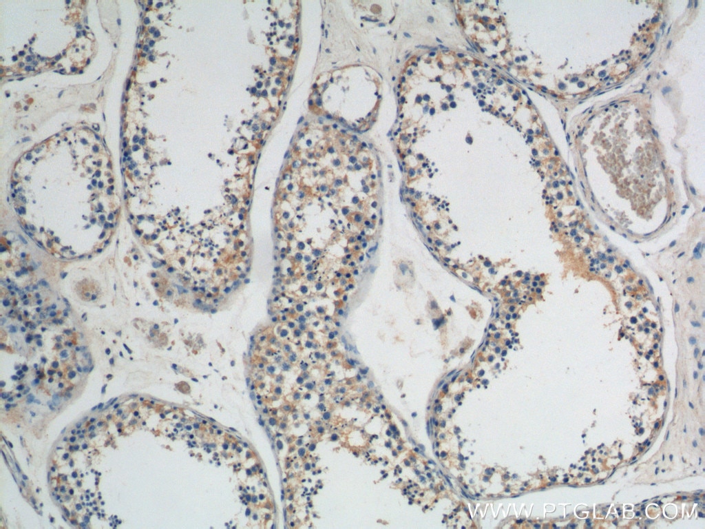 IHC staining of human testis using 19504-1-AP