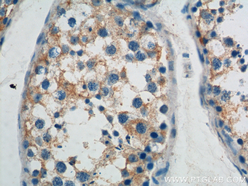 Immunohistochemistry (IHC) staining of human testis tissue using ATP9A Polyclonal antibody (19504-1-AP)