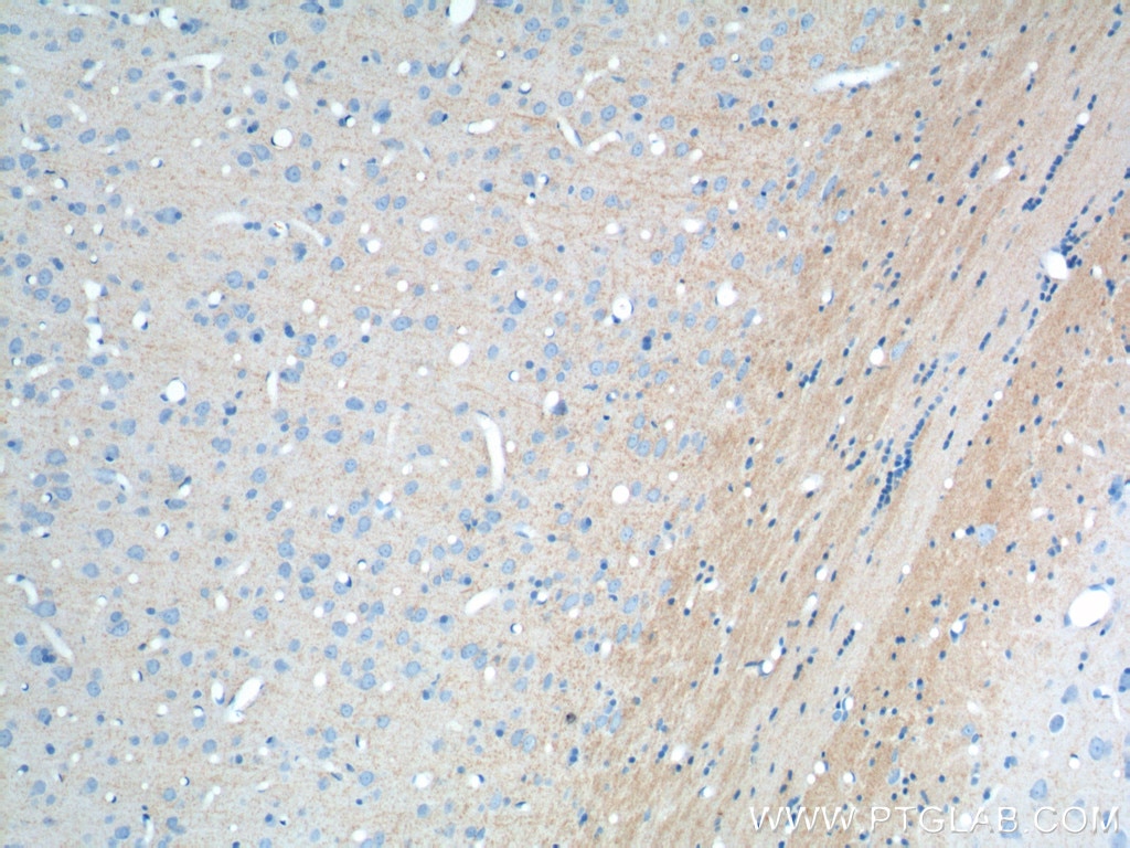 Immunohistochemistry (IHC) staining of rat brain tissue using ATP9A Polyclonal antibody (19504-1-AP)