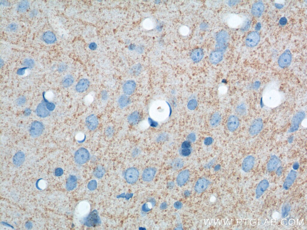 Immunohistochemistry (IHC) staining of rat brain tissue using ATP9A Polyclonal antibody (19504-1-AP)