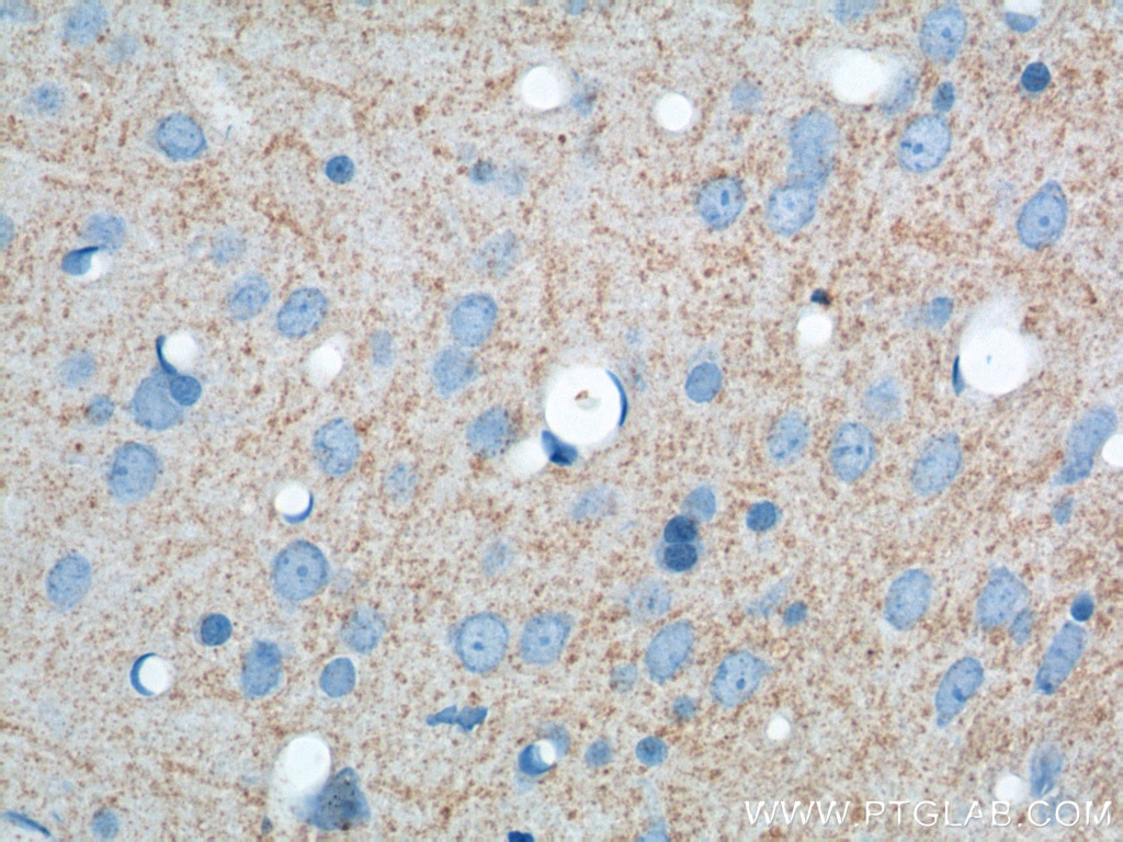 IHC staining of rat brain using 19504-1-AP