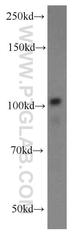 Western Blot (WB) analysis of mouse spleen tissue using ATP9A Polyclonal antibody (19504-1-AP)