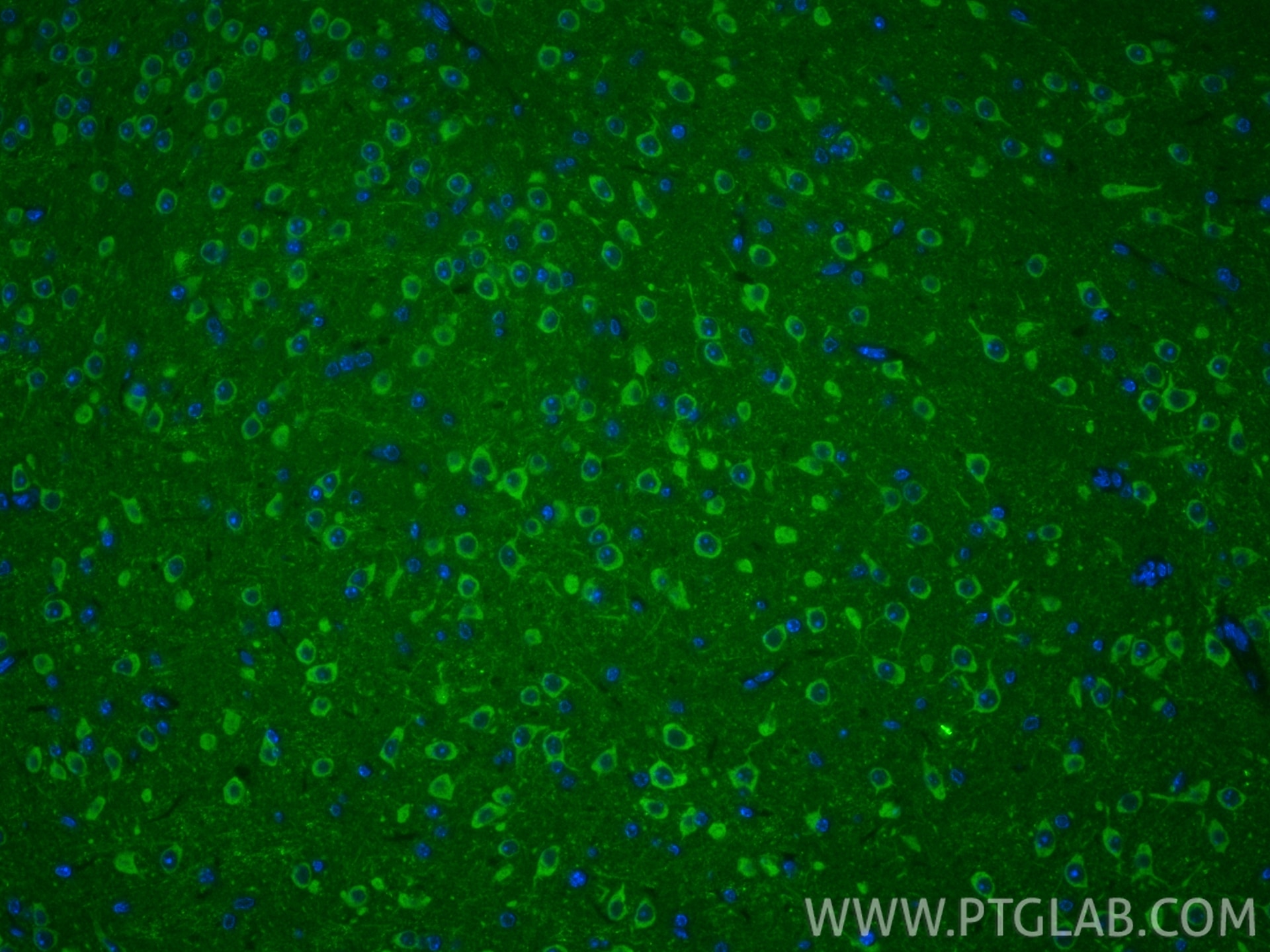 Immunofluorescence (IF) / fluorescent staining of mouse brain tissue using ATPAF1 Polyclonal antibody (18016-1-AP)