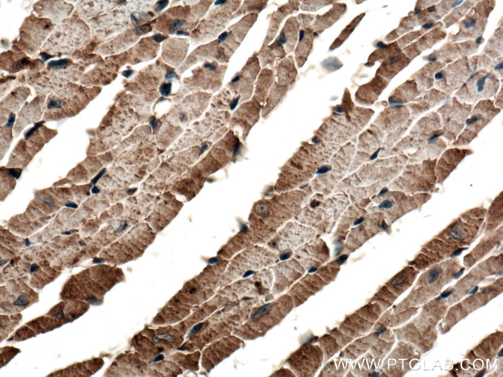 IHC staining of mouse heart using 11598-1-AP