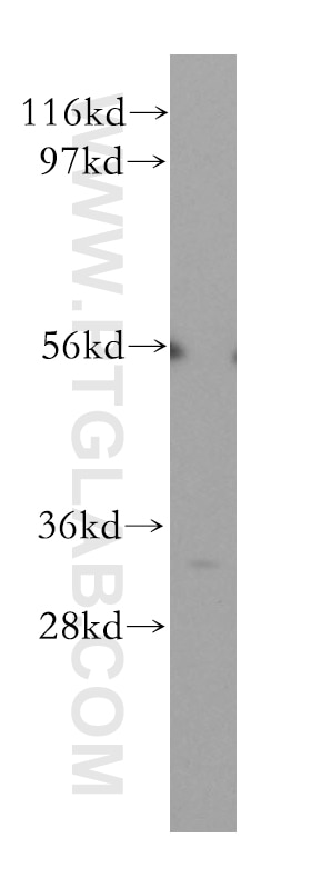 Western Blot (WB) analysis of HEK-293 cells using ATPAF2 Polyclonal antibody (11598-1-AP)