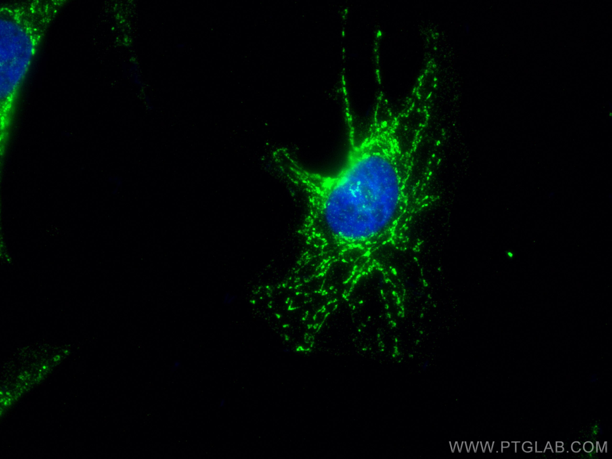 Immunofluorescence (IF) / fluorescent staining of HeLa cells using ATPB Polyclonal antibody (17247-1-AP)