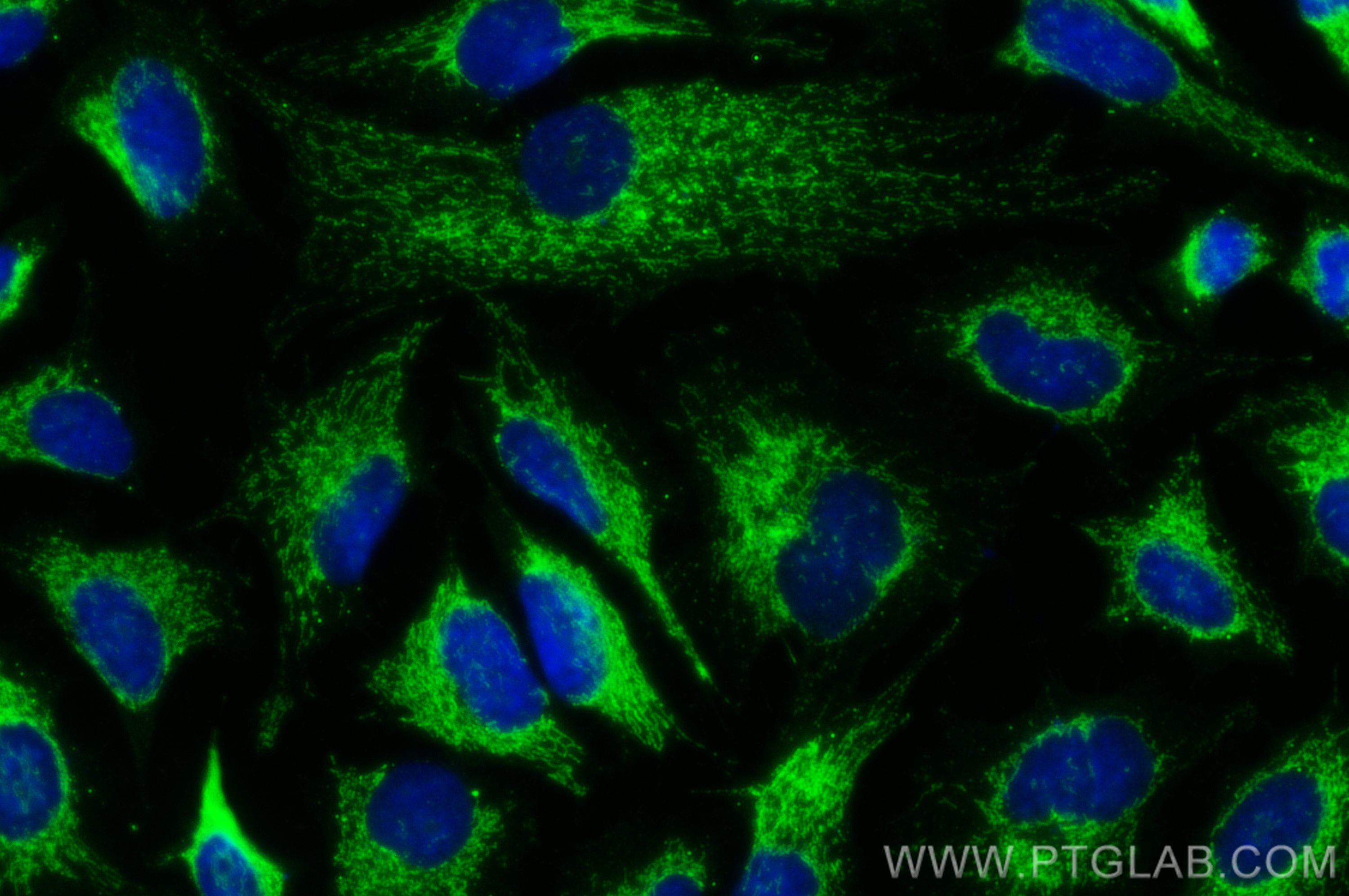 Immunofluorescence (IF) / fluorescent staining of HeLa cells using ATPB Polyclonal antibody (17247-1-AP)