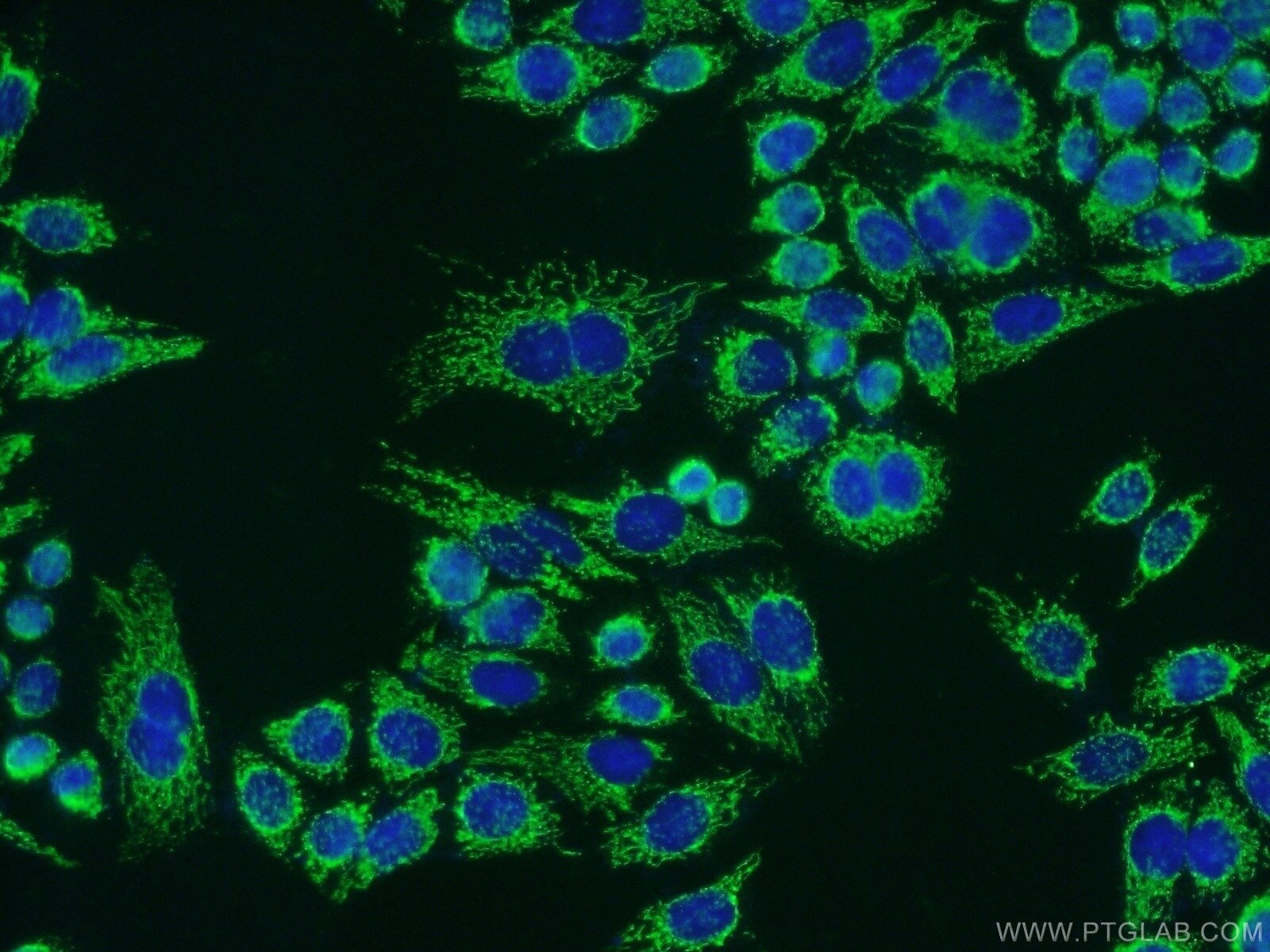 Immunofluorescence (IF) / fluorescent staining of HeLa cells using ATPB Polyclonal antibody (17247-1-AP)