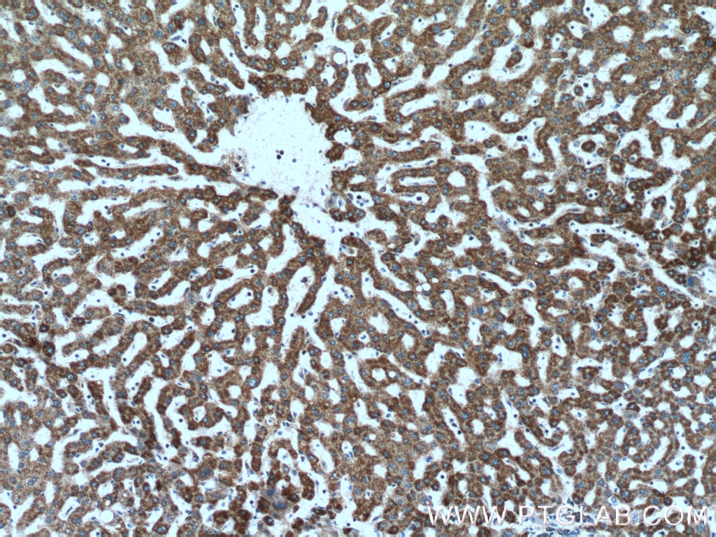 Immunohistochemistry (IHC) staining of human liver tissue using ATPB Polyclonal antibody (17247-1-AP)