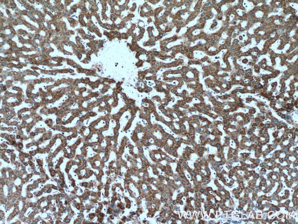 IHC staining of human liver using 17247-1-AP