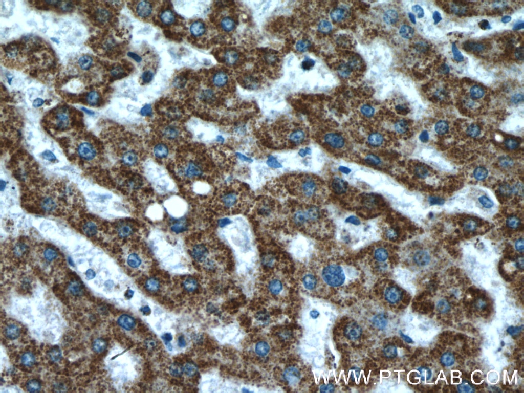 IHC staining of human liver using 17247-1-AP