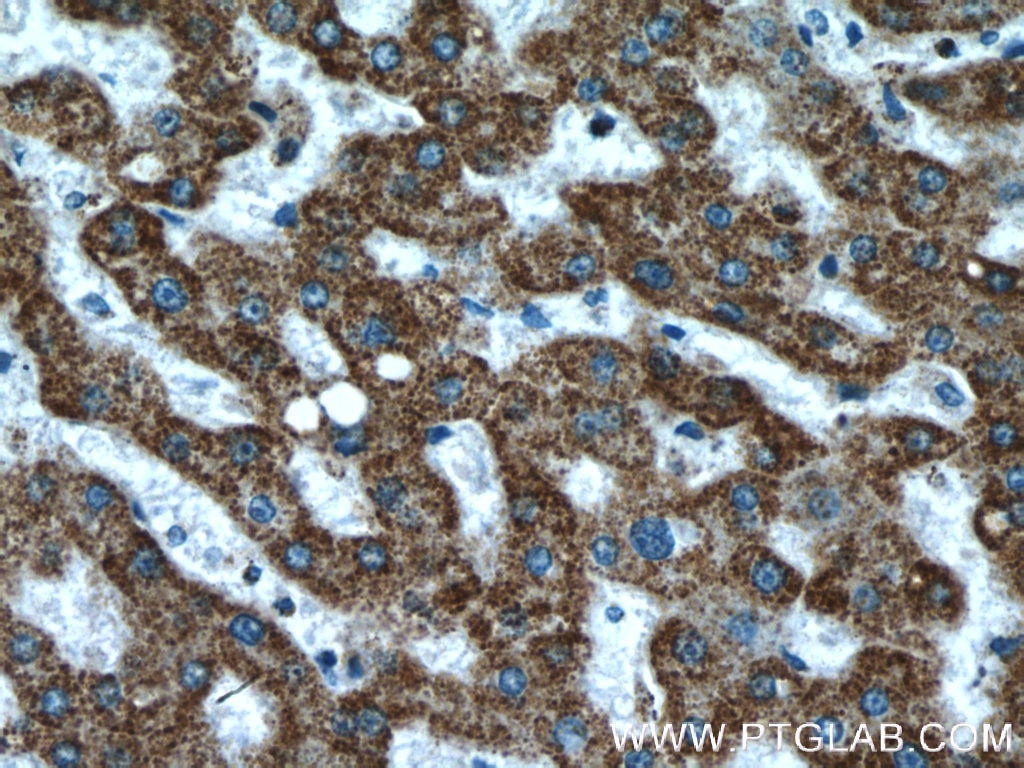 ATPB Polyclonal antibody