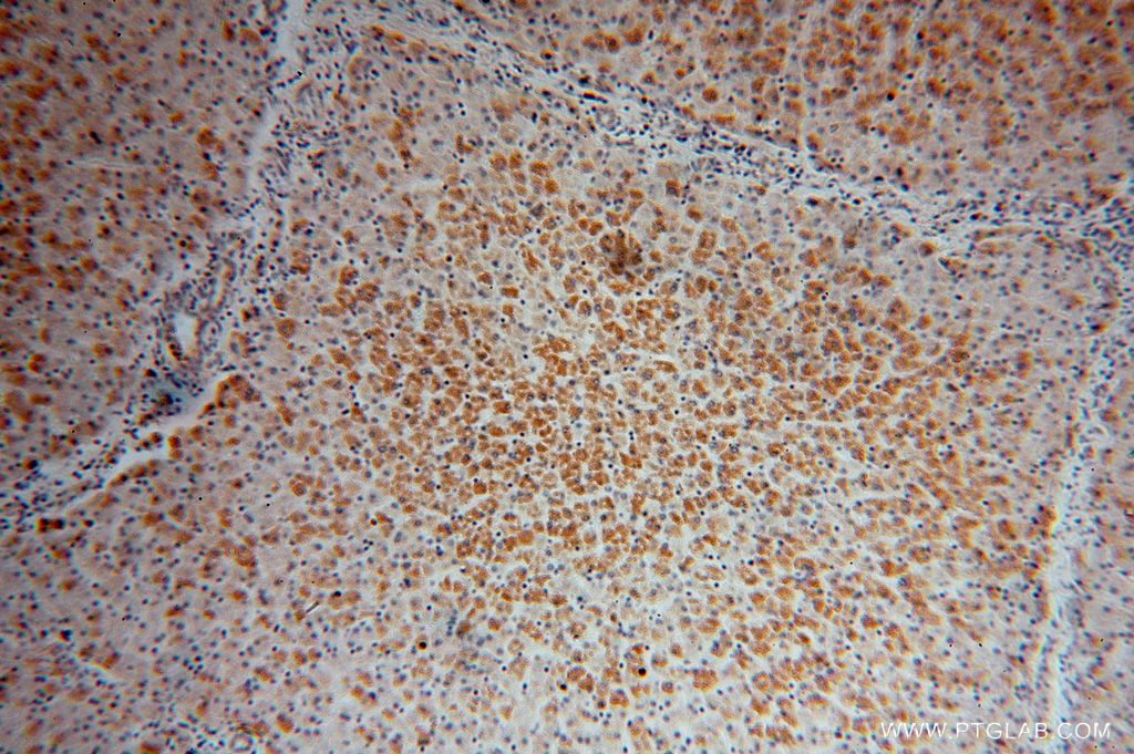 ATPB Polyclonal antibody