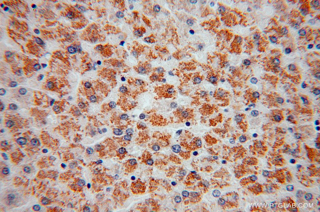 Immunohistochemistry (IHC) staining of human liver tissue using ATPB Polyclonal antibody (17247-1-AP)