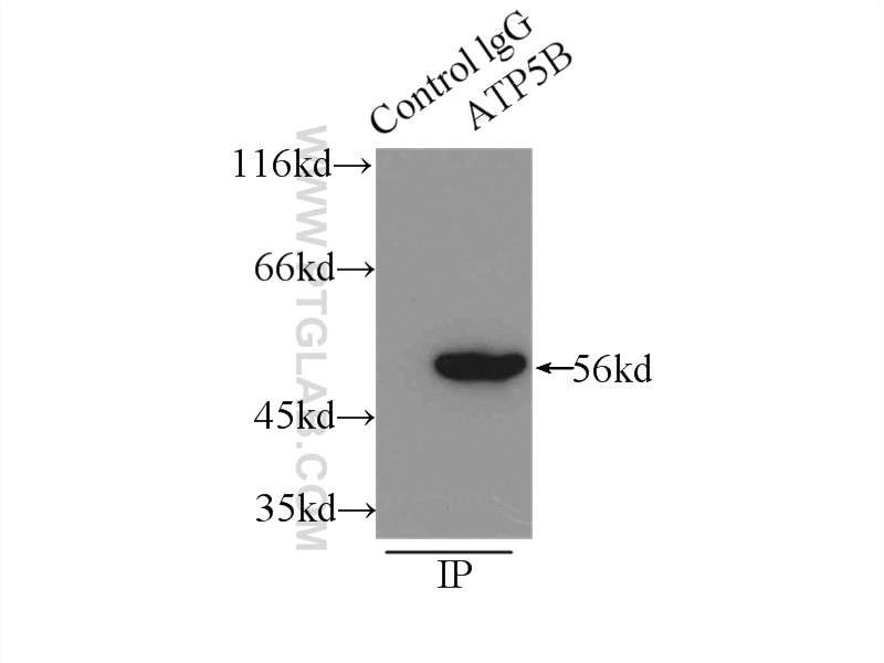 Immunoprecipitation (IP) experiment of mouse heart tissue using ATPB Polyclonal antibody (17247-1-AP)