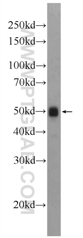Western Blot (WB) analysis of rat heart tissue using ATPB Polyclonal antibody (17247-1-AP)