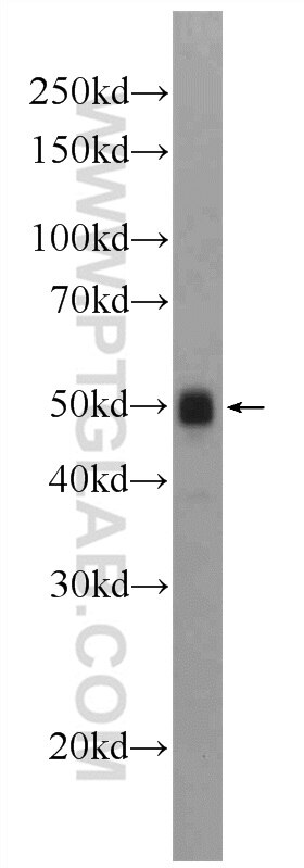 Western Blot (WB) analysis of rat heart tissue using ATPB Polyclonal antibody (17247-1-AP)
