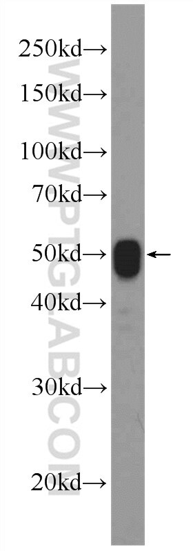 Western Blot (WB) analysis of rat liver tissue using ATPB Polyclonal antibody (17247-1-AP)