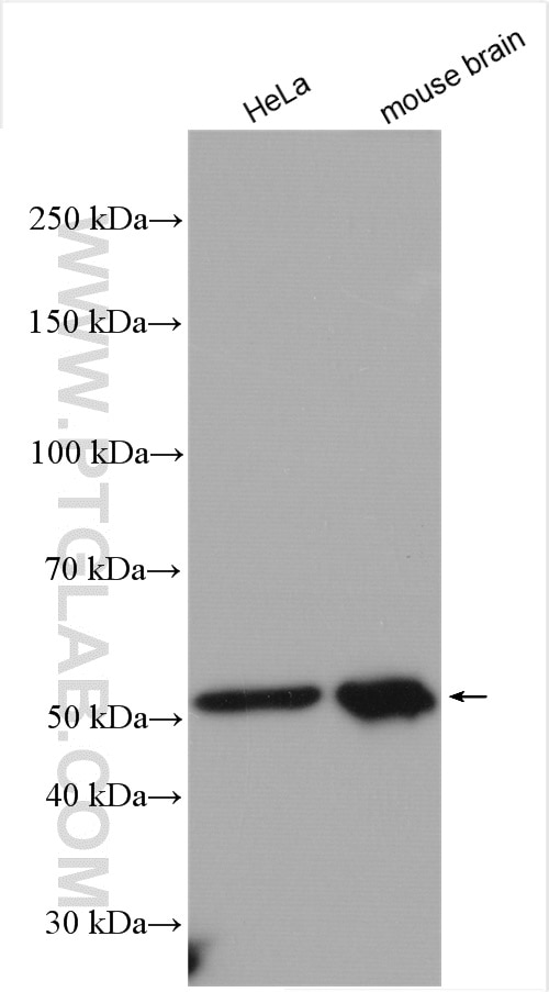 Western Blot (WB) analysis of various lysates using ATPB Polyclonal antibody (17247-1-AP)