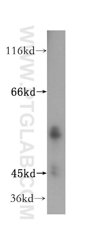Western Blot (WB) analysis of mouse liver tissue using ATPB Polyclonal antibody (17247-1-AP)