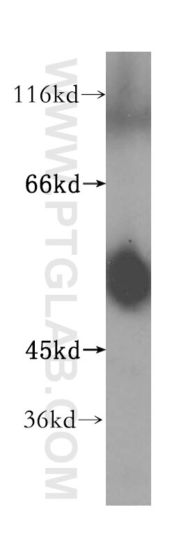 Western Blot (WB) analysis of human heart tissue using ATPB Polyclonal antibody (17247-1-AP)