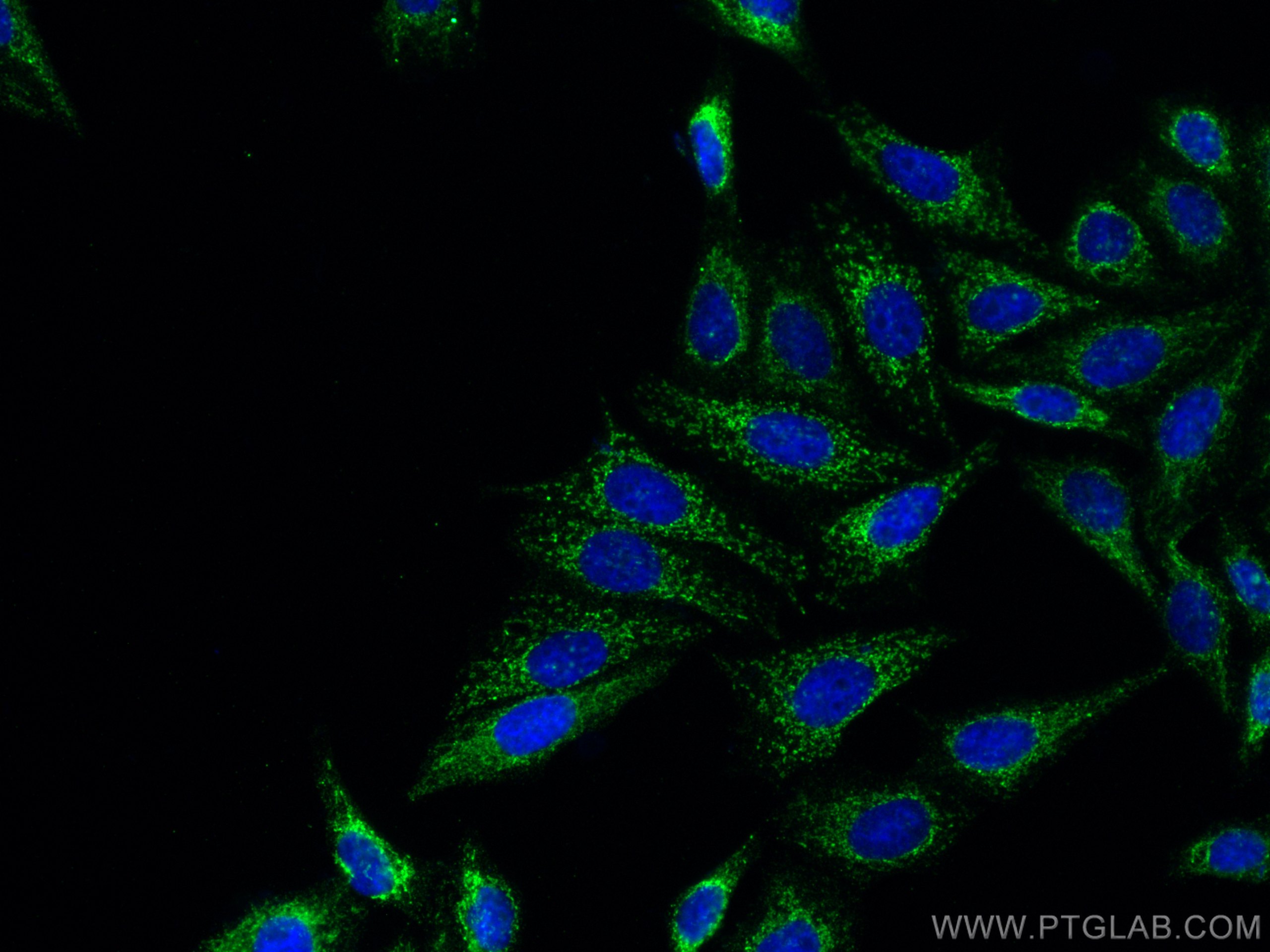 IF Staining of HepG2 using 66600-1-Ig