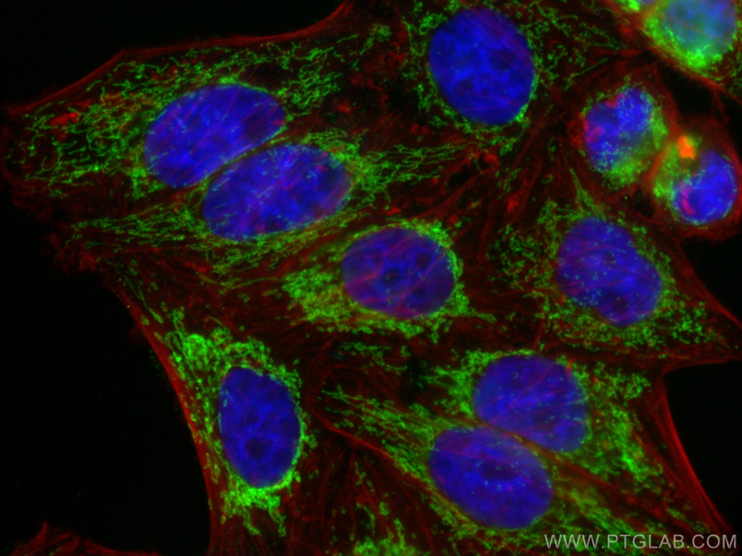 Immunofluorescence (IF) / fluorescent staining of HepG2 cells using ATPB Monoclonal antibody (66600-1-Ig)