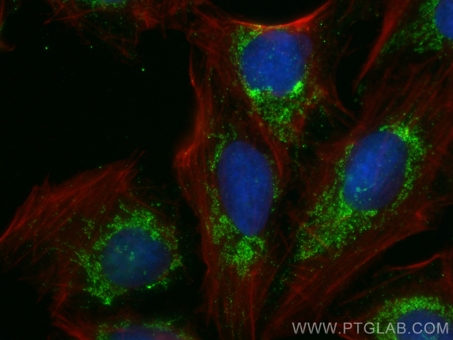 Immunofluorescence (IF) / fluorescent staining of U2OS cells using ATPB Monoclonal antibody (66600-1-Ig)