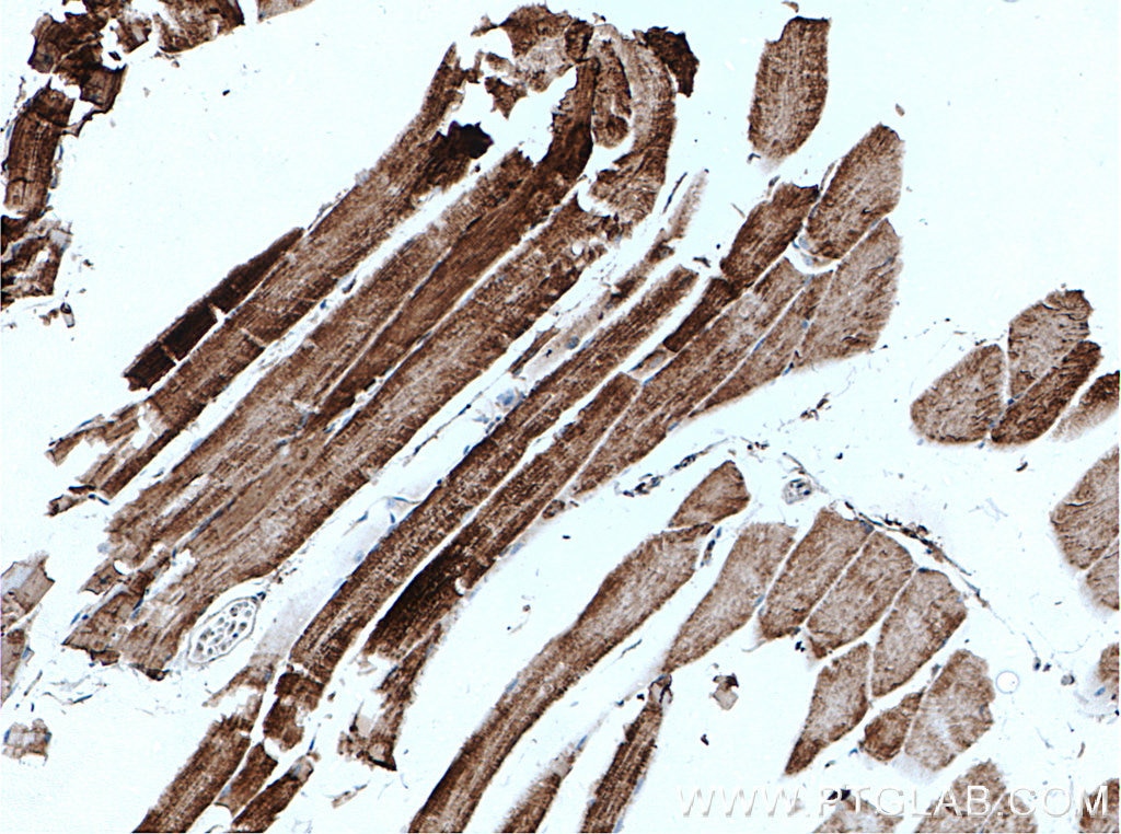 Immunohistochemistry (IHC) staining of mouse skeletal muscle tissue using ATPB Monoclonal antibody (66600-1-Ig)