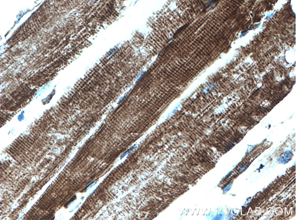 IHC staining of mouse skeletal muscle using 66600-1-Ig
