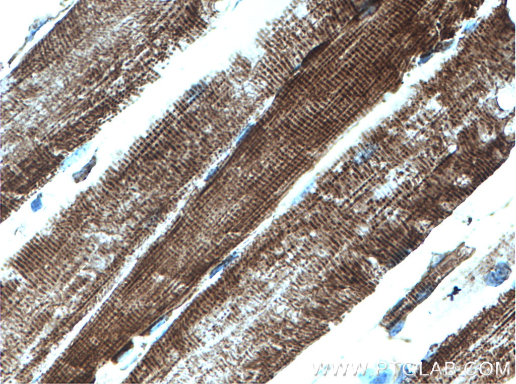 Immunohistochemistry (IHC) staining of mouse skeletal muscle tissue using ATPB Monoclonal antibody (66600-1-Ig)