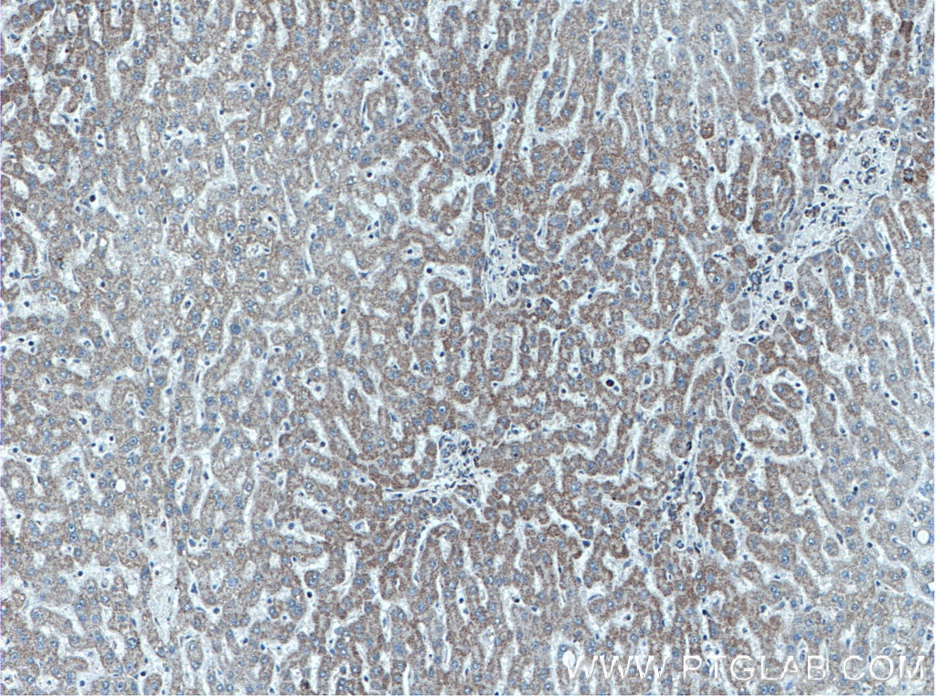 Immunohistochemistry (IHC) staining of human liver tissue using ATPB Monoclonal antibody (66600-1-Ig)