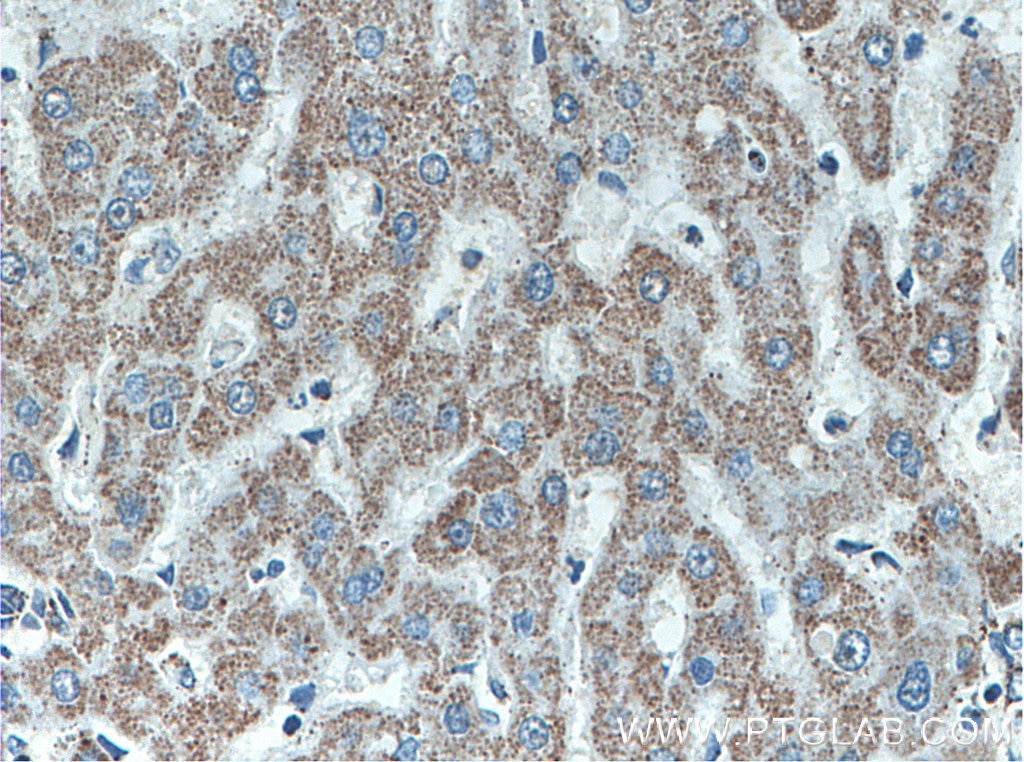 IHC staining of human liver using 66600-1-Ig