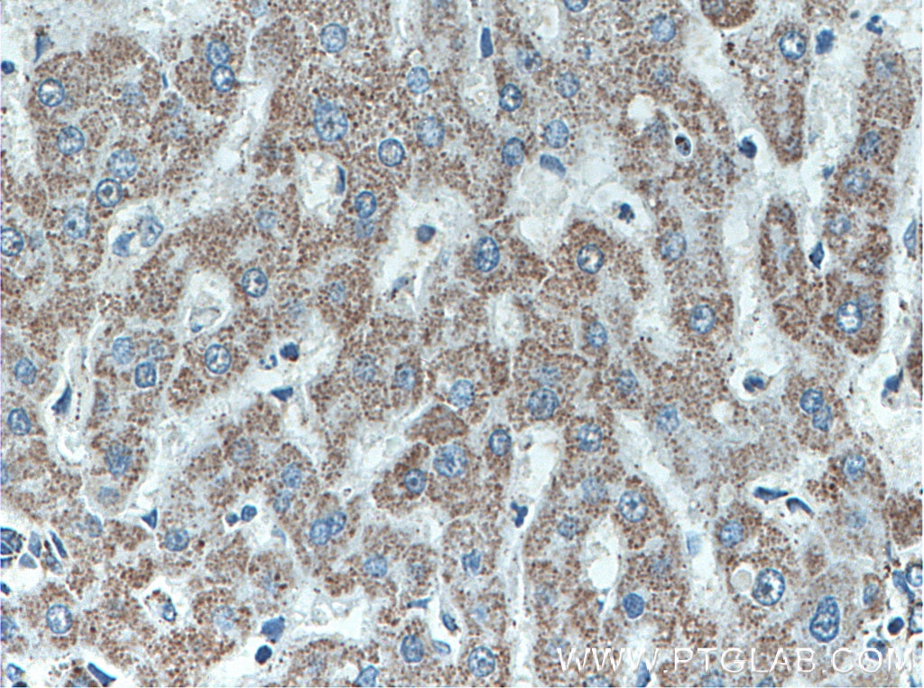 Immunohistochemistry (IHC) staining of human liver tissue using ATPB Monoclonal antibody (66600-1-Ig)