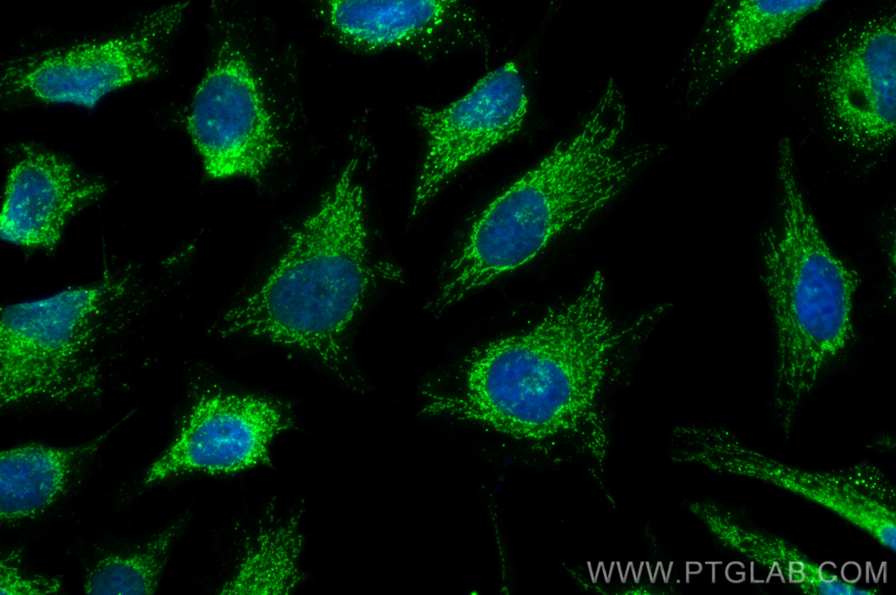 Immunofluorescence (IF) / fluorescent staining of HeLa cells using CoraLite® Plus 488-conjugated ATPB Polyclonal anti (CL488-17247)