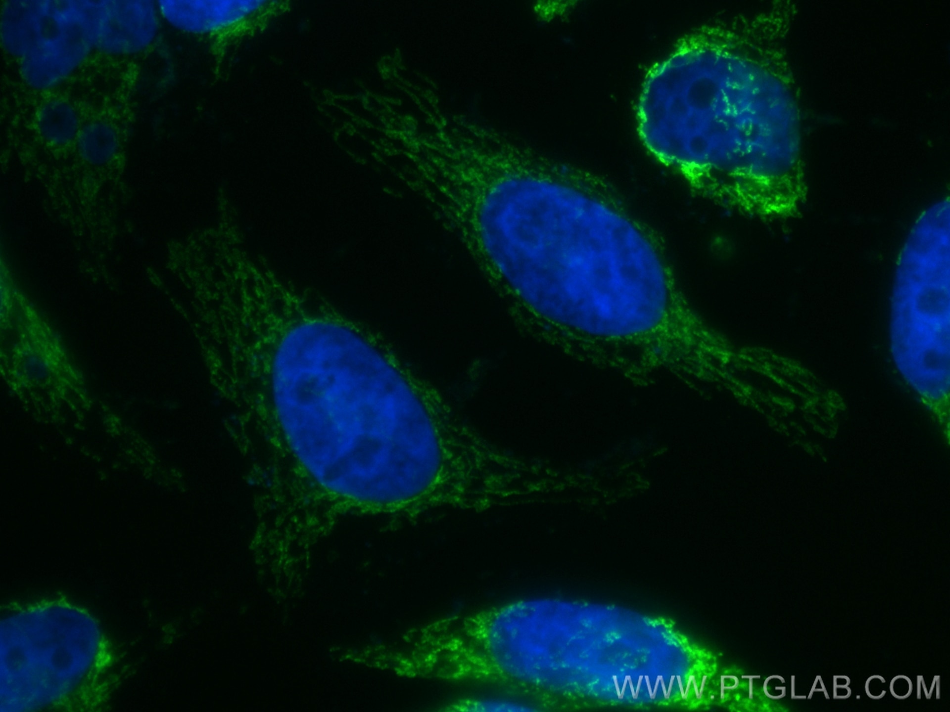Immunofluorescence (IF) / fluorescent staining of HeLa cells using CoraLite® Plus 488-conjugated ATPB Monoclonal anti (CL488-66600)