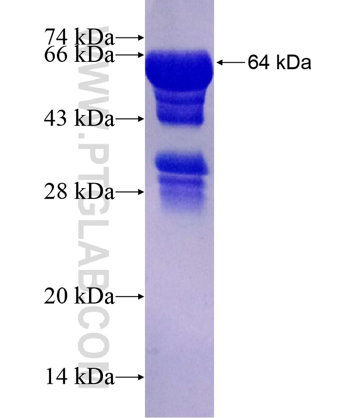 ATPB fusion protein Ag11177 SDS-PAGE