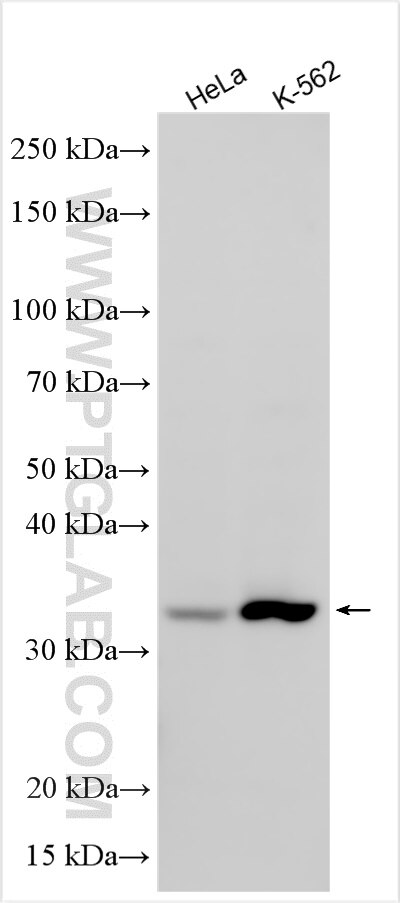 Western Blot (WB) analysis of various lysates using ATPBD3 Polyclonal antibody (31537-1-AP)