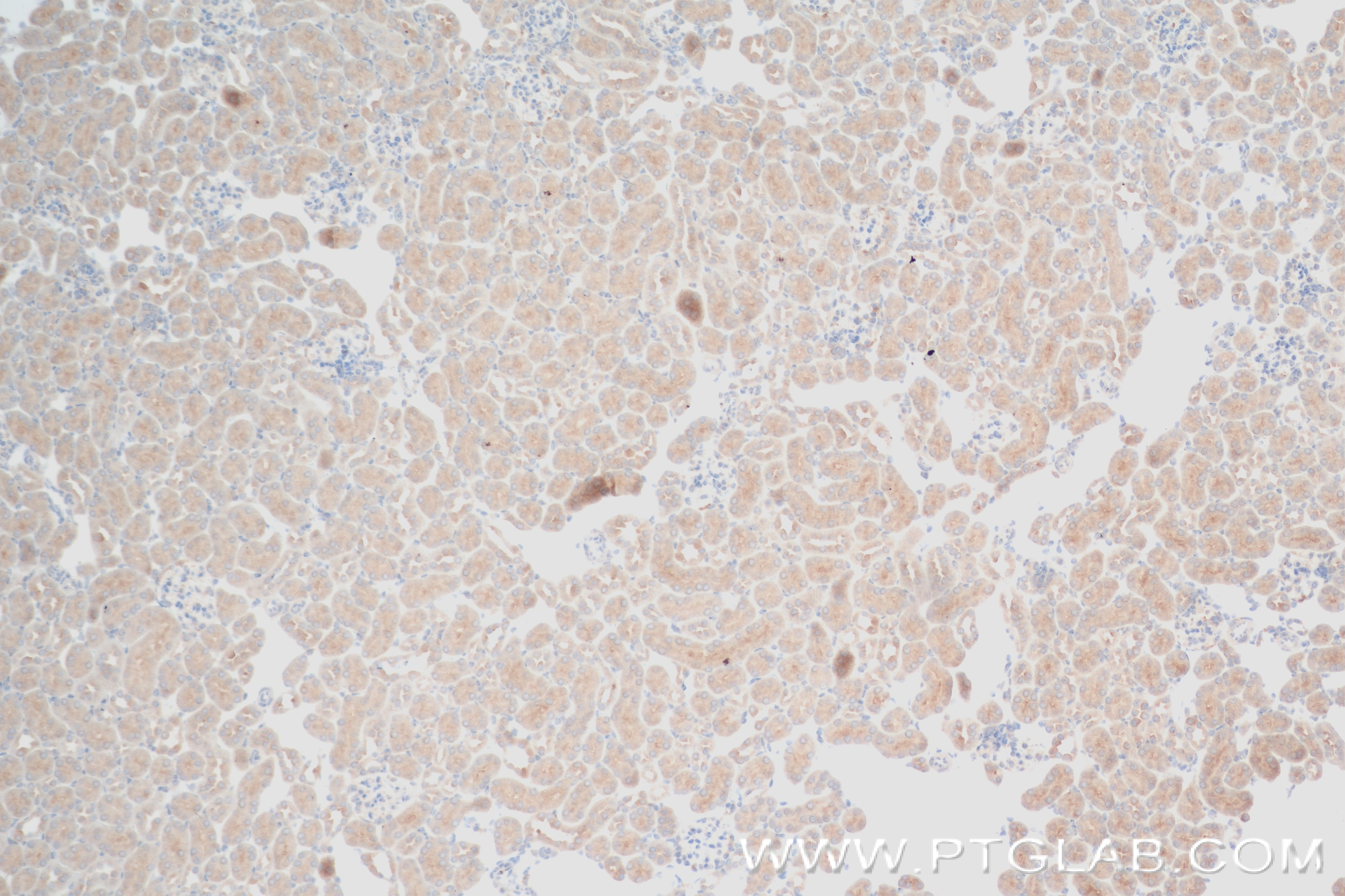 Immunohistochemistry (IHC) staining of mouse kidney tissue using ATPBD3 Recombinant antibody (84318-4-RR)