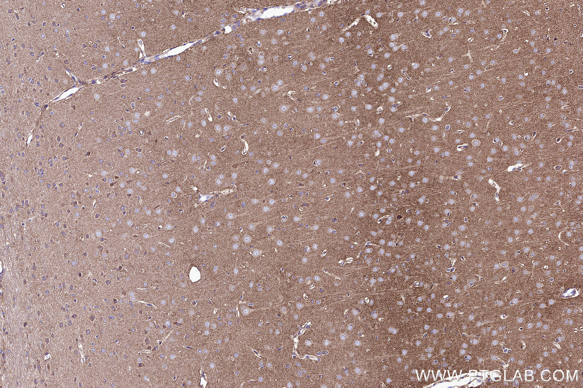 IHC staining of rat brain using 84318-4-RR Immunohistochemistry (IHC) staining of rat brain tissue using ATPBD3 Recombinant monoclonal antibody (84318-4-RR)