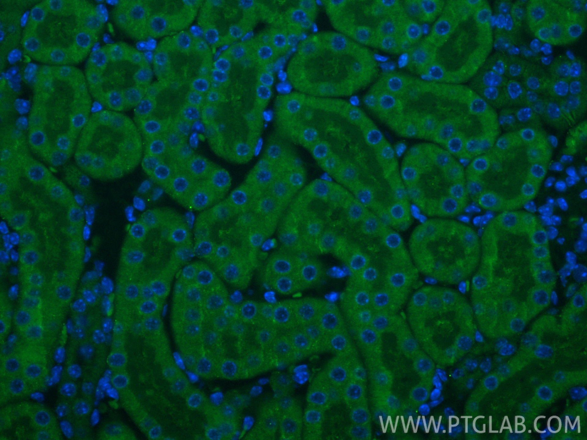 Immunofluorescent analysis of (4% PFA) fixed paraffin-embedded mouse kidney tissue using CoraLite® Plus 488 ATPBD3 antibody (CL488-84318-4, Clone: 241630C4 ) at dilution of 1:200. Heat mediated antigen retrieval with Tris-EDTA buffer (pH 9.0). Immunofluorescence (IF) / fluorescent staining of mouse kidney tissue using CoraLite® Plus 488-conjugated ATPBD3 Recombinant m (CL488-84318-4)