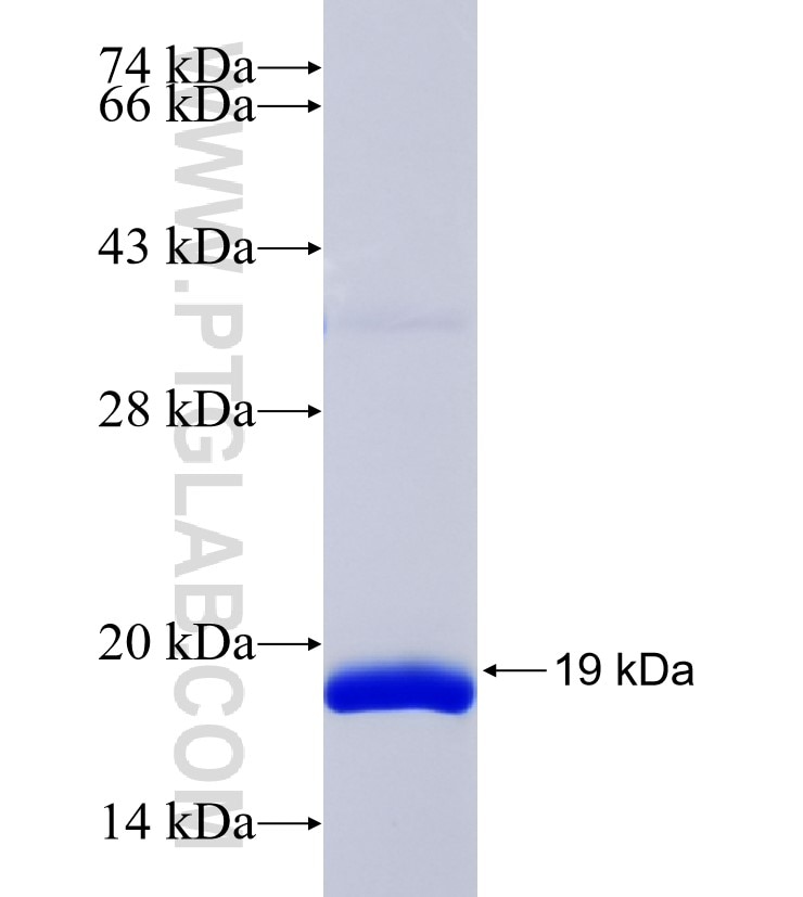 ATPBD3 fusion protein Ag35050 SDS-PAGE