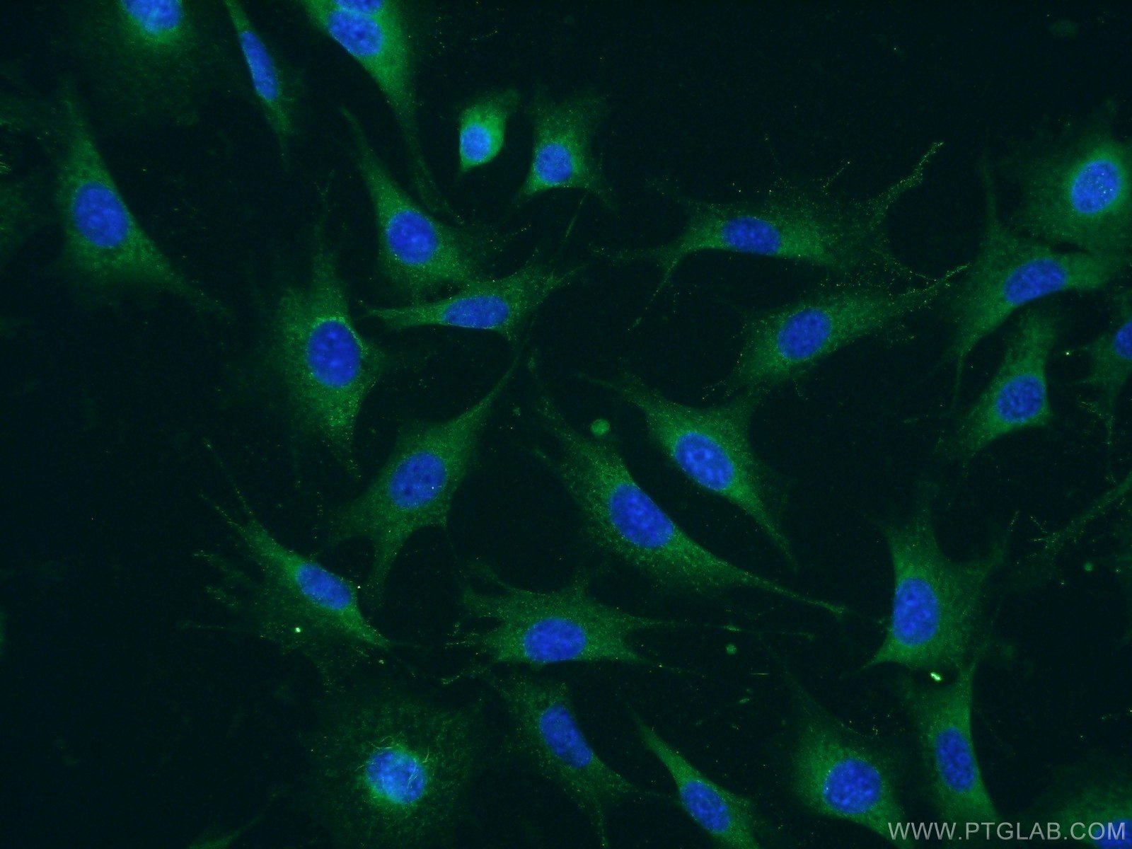Immunofluorescence (IF) / fluorescent staining of NIH/3T3 cells using ATPBD4 Polyclonal antibody (23993-1-AP)