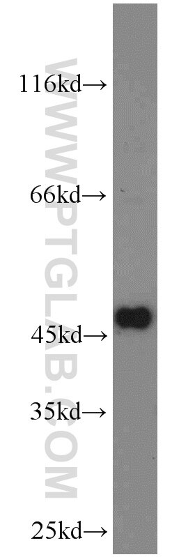 Western Blot (WB) analysis of NIH/3T3 cells using ATPBD4 Polyclonal antibody (23993-1-AP)