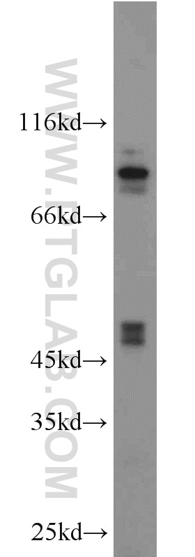 Western Blot (WB) analysis of L02 cells using ATPBD4 Polyclonal antibody (23993-1-AP)