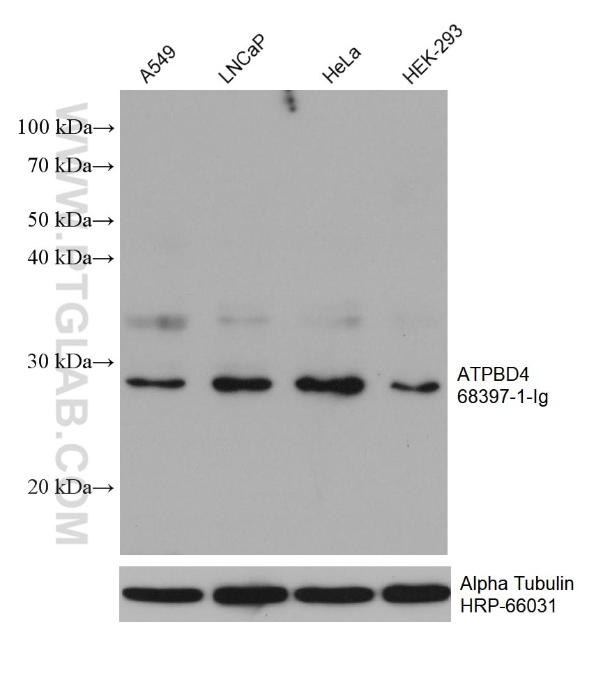Western Blot (WB) analysis of various lysates using ATPBD4 Monoclonal antibody (68397-1-Ig)