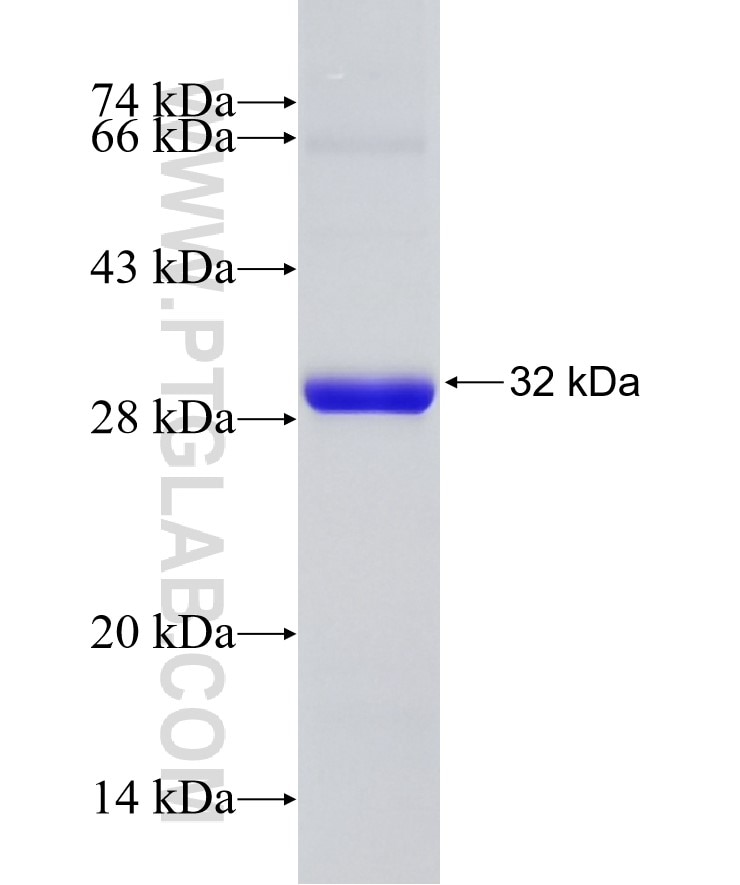ATPBD4 fusion protein Ag33218 SDS-PAGE