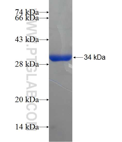 ATPBD4 fusion protein Ag21178 SDS-PAGE