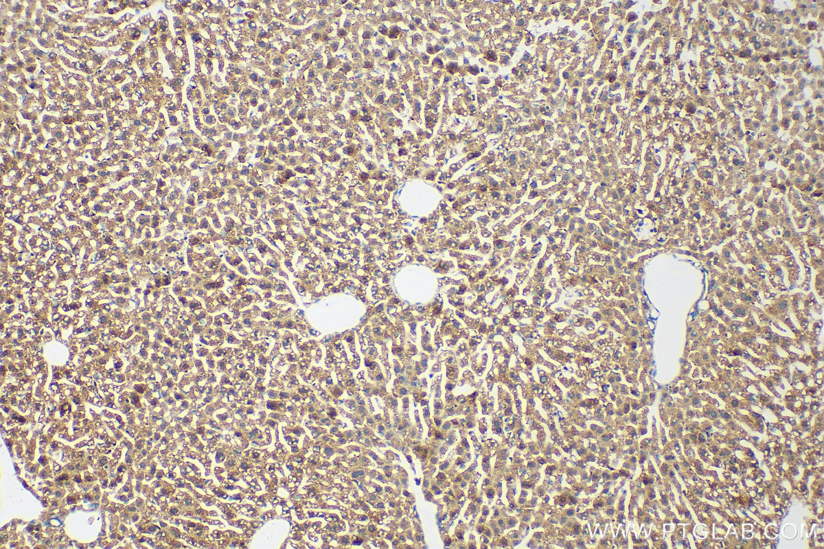 Immunohistochemistry (IHC) staining of mouse liver tissue using CARNS1 Polyclonal antibody (25725-1-AP)